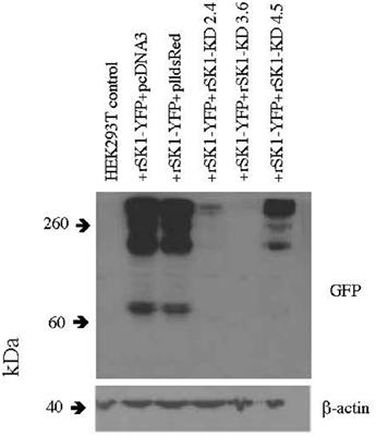 rSK1 in Rat Neurons: A Controller of Membrane rSK2?